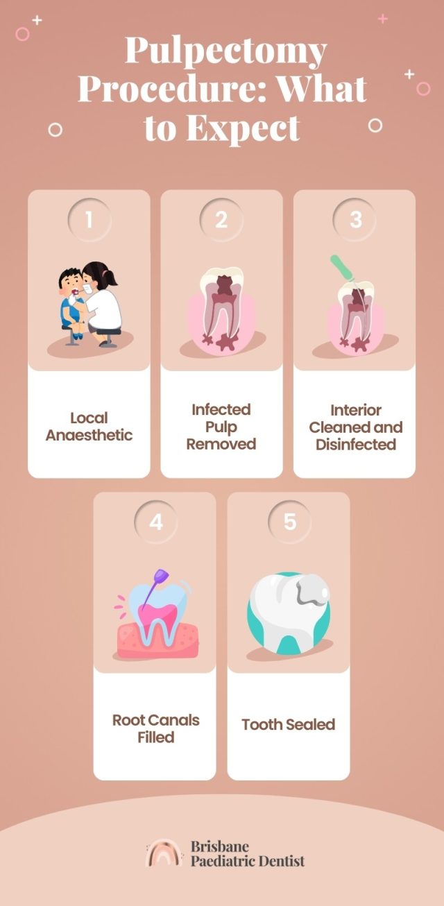 Pulpectomy Procedure Step-by-Step Procedure