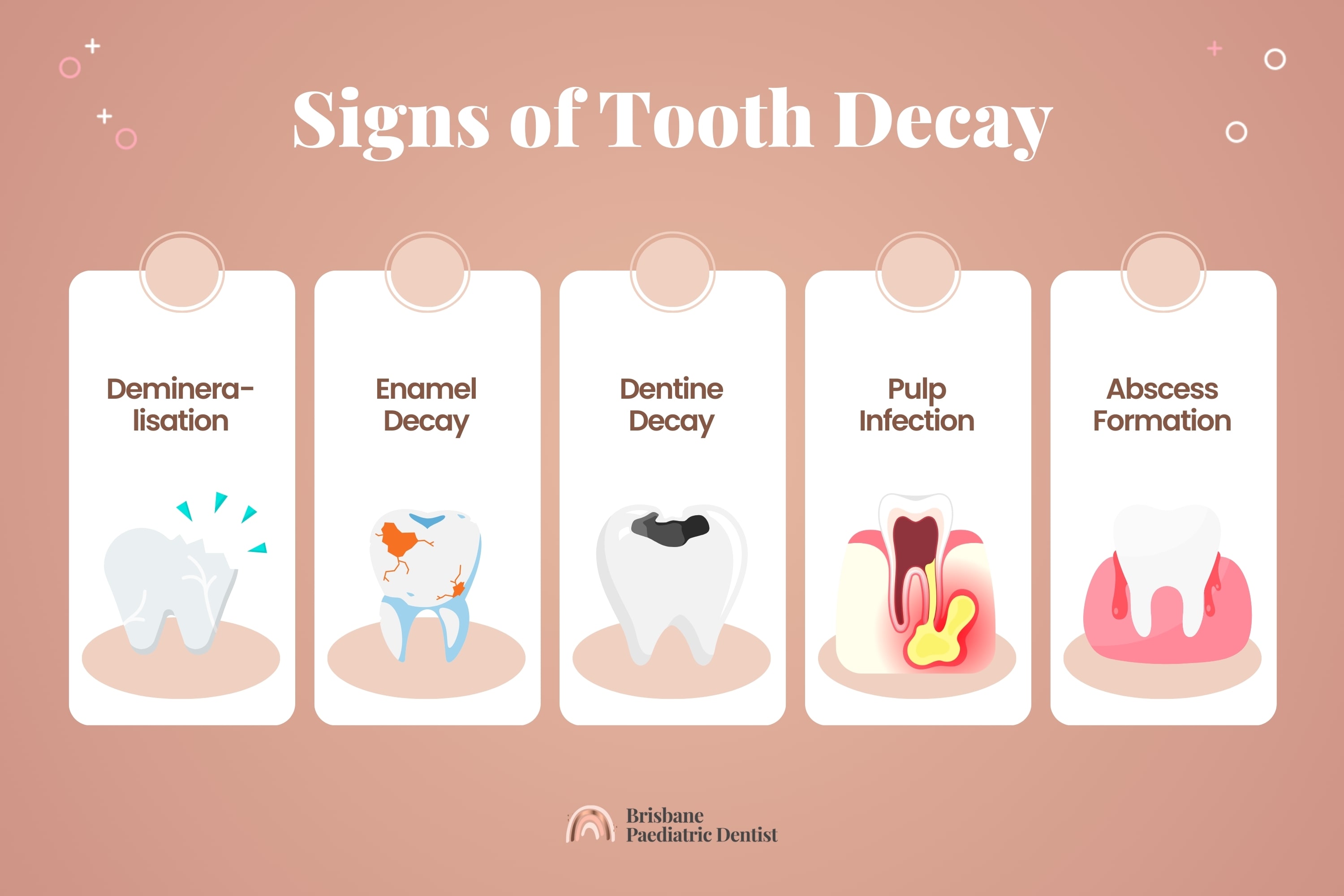 Tooth Decay