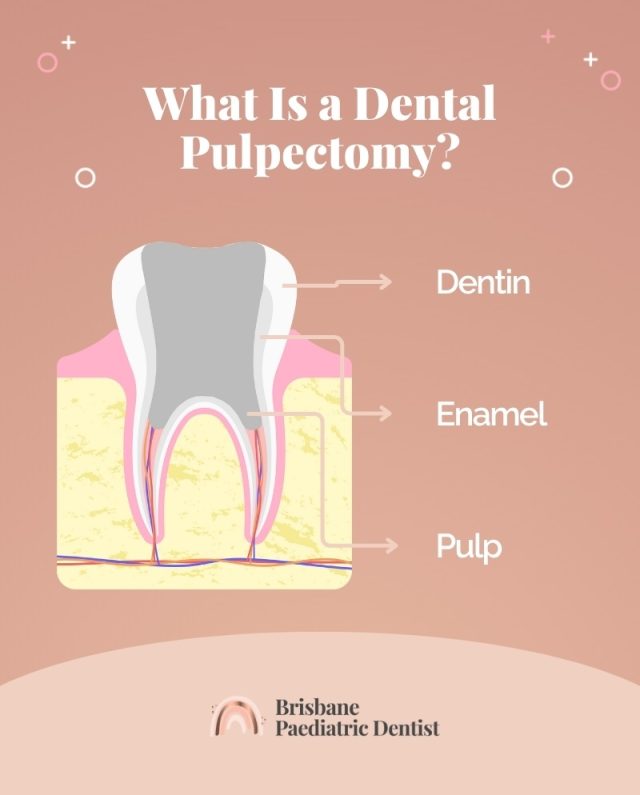 Cross section image of a Tooth - showing the different components of a tooth